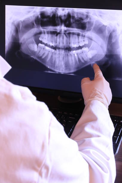 Best Emergency Dentist for Lost Fillings or Crowns in Sibley, LA