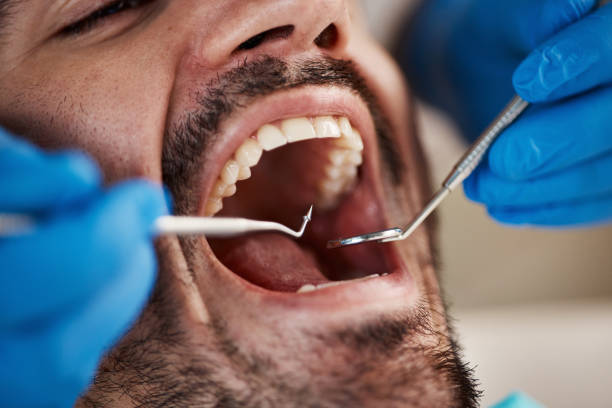 Best Pediatric Emergency Dentist in Sibley, LA